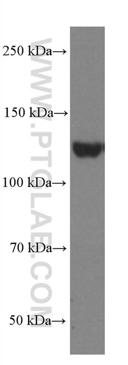 EPHA7 Mouse anti-Human, Mouse, Porcine, Rat, Clone: 1A7E5, Proteintech