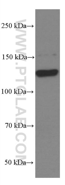 EPHA7 Mouse anti-Human, Mouse, Porcine, Rat, Clone: 1A7E5, Proteintech