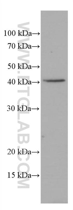 ASGR1 Mouse anti-Human, Mouse, Porcine, Clone: 1G5F5, Proteintech:Antibodies:Primary