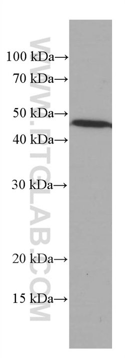 ASGR1 Mouse anti-Human, Mouse, Porcine, Clone: 1G5F5, Proteintech:Antibodies:Primary