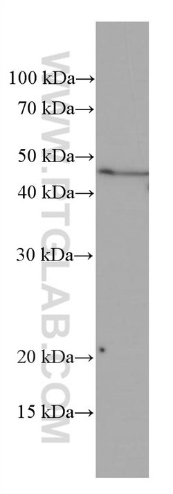 ASGR1 Mouse anti-Human, Mouse, Porcine, Clone: 1G5F5, Proteintech:Antibodies:Primary