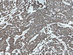ATP5O Mouse anti-Human, Clone: 1D3B8, Proteintech 150 &mu;L; Unconjugated:Antibodies,