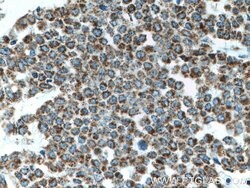 ATP5O Mouse anti-Human, Clone: 1D3B8, Proteintech 150 &mu;L; Unconjugated:Antibodies,