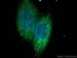 MTAP Mouse anti-Human, Mouse, Rat, Clone: 2B1G6, Proteintech:Antibodies:Primary