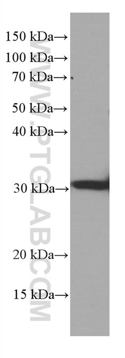 MTAP Mouse anti-Human, Mouse, Rat, Clone: 2B1G6, Proteintech:Antibodies:Primary