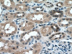 MTAP Mouse anti-Human, Mouse, Rat, Clone: 2B1G6, Proteintech:Antibodies:Primary