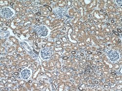 MTAP Mouse anti-Human, Mouse, Rat, Clone: 2B1G6, Proteintech:Antibodies:Primary