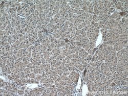 MTAP Mouse anti-Human, Mouse, Rat, Clone: 2B1G6, Proteintech:Antibodies:Primary