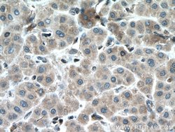 MTAP Mouse anti-Human, Mouse, Rat, Clone: 2B1G6, Proteintech:Antibodies:Primary