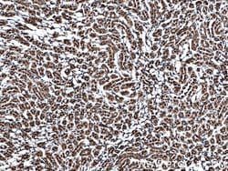 MTAP Mouse anti-Human, Mouse, Rat, Clone: 2B1G6, Proteintech:Antibodies:Primary