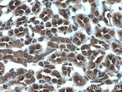 MTAP Mouse anti-Human, Mouse, Rat, Clone: 2B1G6, Proteintech:Antibodies:Primary