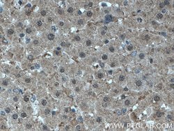 MTAP Mouse anti-Human, Mouse, Rat, Clone: 2B1G6, Proteintech:Antibodies:Primary