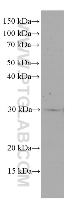 MTAP Mouse anti-Human, Mouse, Rat, Clone: 2B1G6, Proteintech:Antibodies:Primary