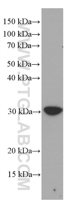MTAP Mouse anti-Human, Mouse, Rat, Clone: 2B1G6, Proteintech:Antibodies:Primary