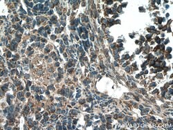 STRAP Mouse anti-Human, Clone: 5E11F3, Proteintech:Antibodies:Primary Antibodies