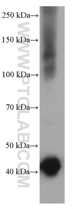 CNPase Mouse anti-Human, Porcine, Rat, Clone: 1B9G9, Proteintech 20 &mu;L;