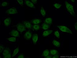 HIF1a Mouse anti-Human, Clone: 1H3C12, Proteintech 150 &mu;L; Unconjugated:Antibodies,