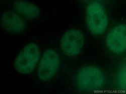 SRF Mouse anti-Human, Clone: 1G8F4, Proteintech:Antibodies:Primary Antibodies
