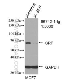 SRF Mouse anti-Human, Clone: 1G8F4, Proteintech:Antibodies:Primary Antibodies