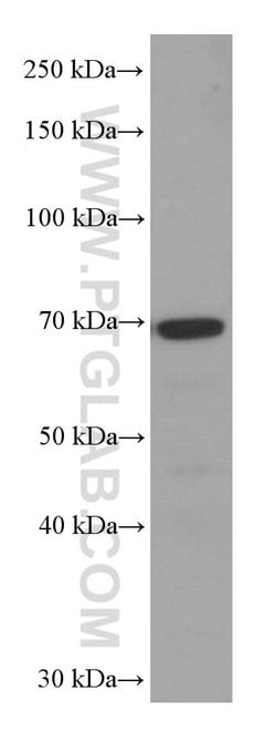 SRF Mouse anti-Human, Clone: 1G8F4, Proteintech:Antibodies:Primary Antibodies