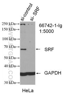 SRF Mouse anti-Human, Clone: 1G8F4, Proteintech:Antibodies:Primary Antibodies