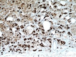 TSH beta Mouse anti-Human, Clone: 2G1H3, Proteintech 150 &mu;L; Unconjugated:Antibodies,
