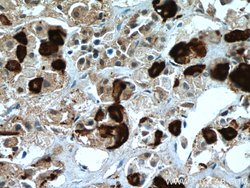 TSH beta Mouse anti-Human, Clone: 2G1H3, Proteintech 150 &mu;L; Unconjugated:Antibodies,