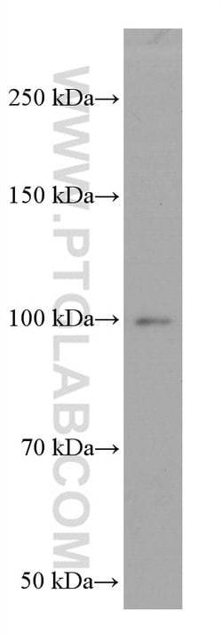 BACH1 Mouse anti-Human, Rat, Clone: 2D12A4, Proteintech 150 &mu;L | Buy Online | Proteintech Group Inc | Fisher Scientific