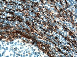 CD90 Mouse anti-Human, Porcine, Rat, Clone: 2D7D11, Proteintech 150 &mu;L;