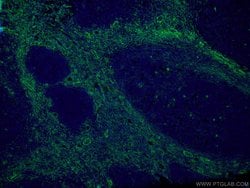 CD90 Mouse anti-Human, Porcine, Rat, Clone: 2D7D11, Proteintech 150 &mu;L;