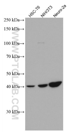 SSTR5 Mouse anti-Human, Mouse, Rat, Clone: 2B10D8, Proteintech:Anticorps:Anticorps