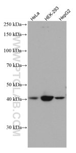 Thumbnail_SSTR5 Mouse anti-Human, Mouse, Rat, Clone: 2B10D8, Proteintech:Anticorps:Anticorps