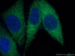 LACTB Mouse anti-Human, Clone: 3C3C3, Proteintech 150 &mu;L; Unconjugated:Antibodies,