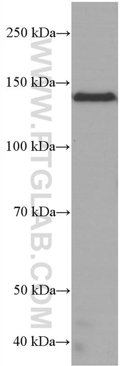 RGS3 Mouse anti-Human, Clone: 1D6A3, Proteintech:Antibodies:Primary Antibodies