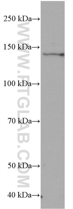 RGS3 Mouse anti-Human, Clone: 1D6A3, Proteintech:Antibodies:Primary Antibodies