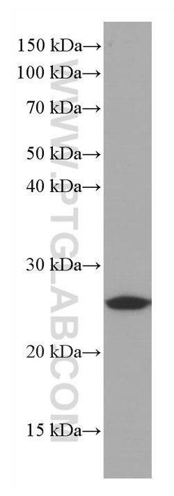 Bcl2 Mouse anti-Mouse, Clone: 1B5B9, Proteintech:Anticuerpos:Anticuerpos
