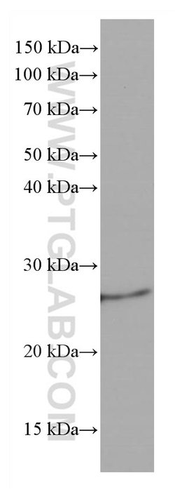 Bcl2 Mouse anti-Mouse, Clone: 1B5B9, Proteintech:Anticuerpos:Anticuerpos