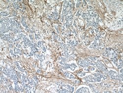 Collagen Type VI Mouse anti-Human, Clone: 3H10B1, Proteintech 150 &mu;L | Buy Online | Proteintech Group Inc | Fisher Scientific