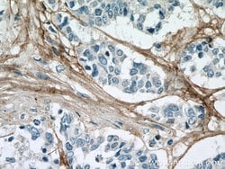 Collagen Type VI Mouse anti-Human, Clone: 3H10B1, Proteintech 150 &mu;L | Buy Online | Proteintech Group Inc | Fisher Scientific