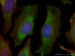 TXNRD1 Mouse anti-Human, Mouse, Rat, Clone: 1B10C4, ProteinTech 150 &mu;L;