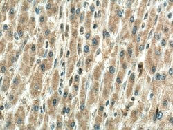 TXNRD1 Mouse anti-Human, Mouse, Rat, Clone: 1B10C4, ProteinTech 150 &mu;L;