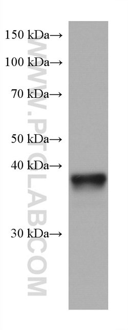 ANKRD1 Mouse anti-Human, Mouse, Porcine, Rabbit, Rat, Clone: 1F11F1, ProteinTech