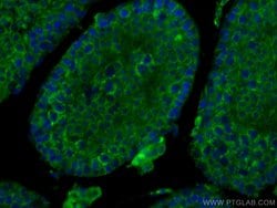 SMCR7L Mouse anti-Human, Mouse, Rat, Clone: 3B3G3, ProteinTech 150 &mu;L;