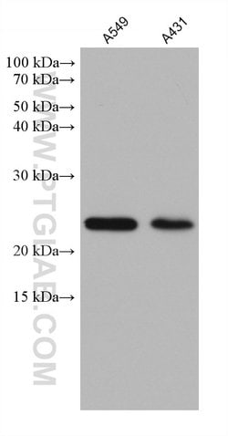 RAB11A Mouse anti-Human, Mouse, Porcine, Rat, Clone: 4A4C9, ProteinTech