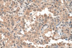 EIF5A2 Mouse anti-Human, Rat, Clone: 1F9B2, ProteinTech 150 &mu;L; Unconjugated:Antibodies,
