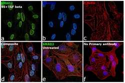 Invitrogen™ SMAD2 Recombinant Rabbit Monoclonal Antibody (31H15L4), Alexa Fluor™ Plus 488