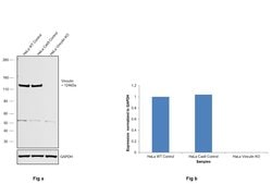 Vinculin Recombinant Rabbit Monoclonal Antibody (42H89L44):Antibodies,