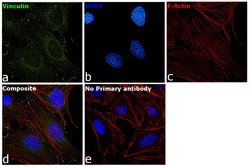 Vinculin Recombinant Rabbit Monoclonal Antibody (42H89L44):Antibodies,