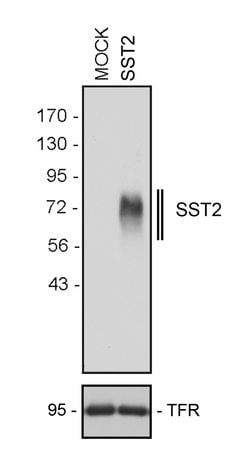 Invitrogen SSTR2 Recombinant Rabbit Monoclonal Antibody (11H21L13) 100