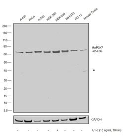 Invitrogen TAK1 Recombinant Rabbit Monoclonal Antibody (28H25L68) 100 &mu;g;
